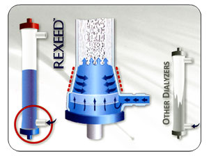 REXEED SX Dialyzer Flow Distibution