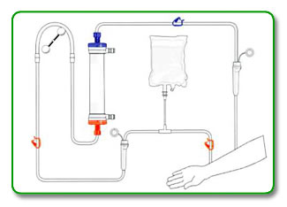 REXEED SX Priming Procedure Step 1